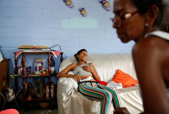 In this 2016 file photo, a woman in San Francisco de Yare, Venezuela, rests on a couch in her home while she recovers from a sterilization surgery. The Catholic Church teaches that sterilization is morally unacceptable, but a hysterectomy could be morally acceptable if the uterus could not sustain a pregnancy, said the Congregation for the Doctrine of the Faith.